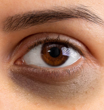 Load image into Gallery viewer, Dark Eye Ring Treatment (Service)