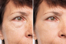 Load image into Gallery viewer, Eye Contour Detox