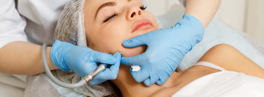 All about Microdermabrasion in Singapore